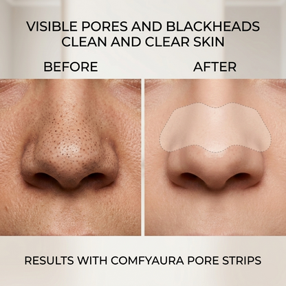 Blackhead Nose Strip