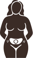 2. Place Device